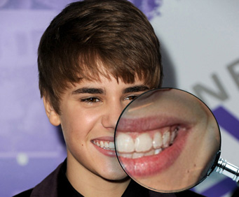 justin-bieber-invisalign2.jpg